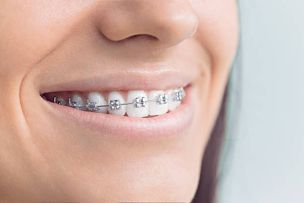 Full Mouth Reconstruction in Dayton, TN